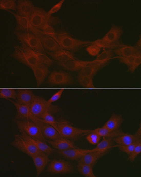 TRAF7 Rabbit Polyclonal Antibody - Image 5