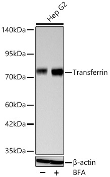 Transferrin Rabbit Monoclonal Antibody