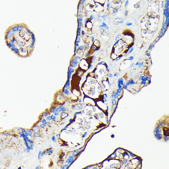 Transferrin Rabbit Monoclonal Antibody - Image 2