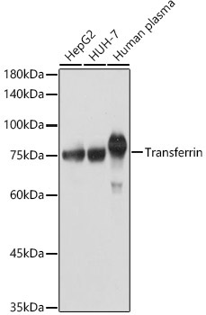 Transferrin Rabbit Polyclonal Antibody