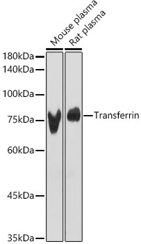 Transferrin Rabbit Polyclonal Antibody - Image 2