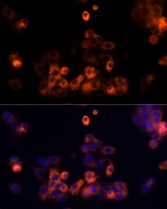 Transferrin Rabbit Polyclonal Antibody - Image 3