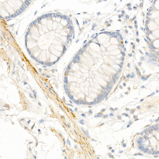 Transgelin (TAGLN) Rabbit Polyclonal Antibody