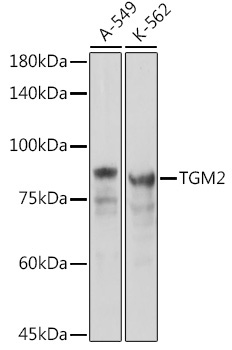 Transglutaminase 2 (TGM2) Rabbit Polyclonal Antibody