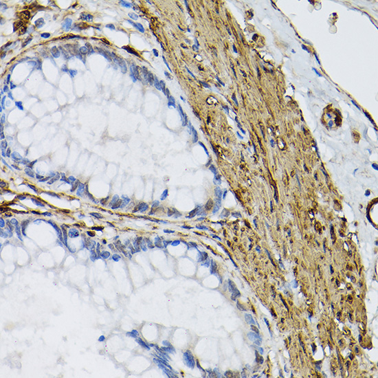 Transglutaminase 2 (TGM2) Rabbit Polyclonal Antibody - Image 2