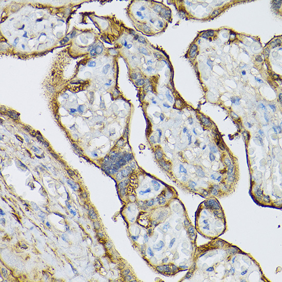 Transglutaminase 2 (TGM2) Rabbit Polyclonal Antibody - Image 3
