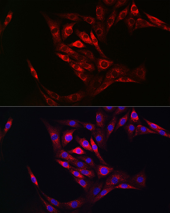 Transglutaminase 2 (TGM2) Rabbit Polyclonal Antibody - Image 4