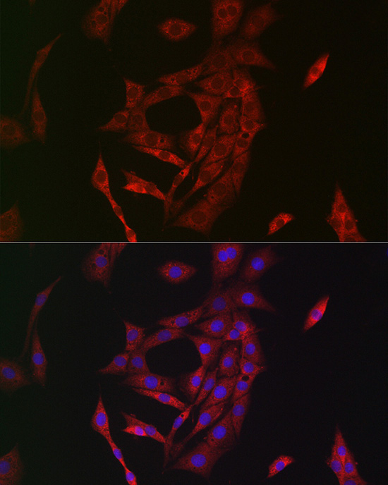 Transglutaminase 2 (TGM2) Rabbit Polyclonal Antibody - Image 5