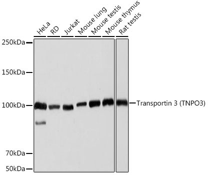 Transportin 3 (TNPO3) Rabbit Monoclonal Antibody