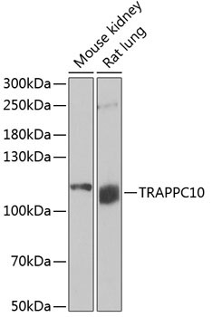 TRAPPC10 Rabbit Polyclonal Antibody