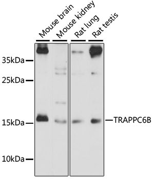 TRAPPC6B Rabbit Polyclonal Antibody
