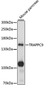 TRAPPC9 Rabbit Polyclonal Antibody