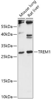 TREM1 Rabbit Polyclonal Antibody