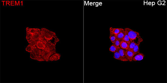 TREM1 Rabbit Polyclonal Antibody