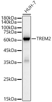 TREM2 Rabbit Monoclonal Antibody