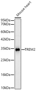 TREM2 Rabbit Monoclonal Antibody