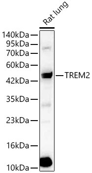 TREM2 Rabbit Polyclonal Antibody