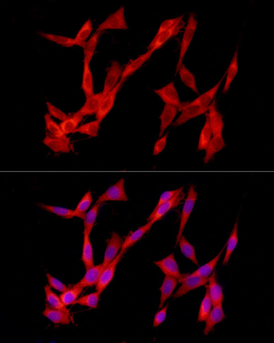 TREM2 Rabbit Polyclonal Antibody - Image 2