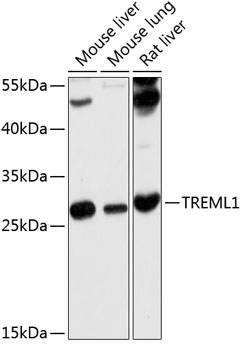 TREML1 Rabbit Polyclonal Antibody