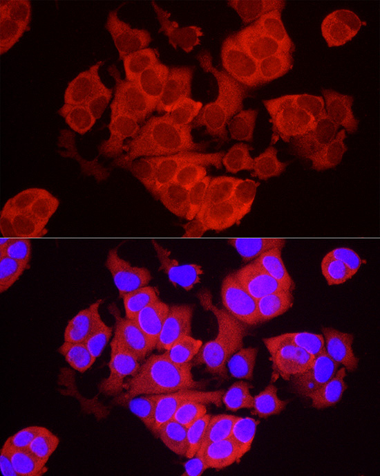 TREX1 Rabbit Polyclonal Antibody - Image 2