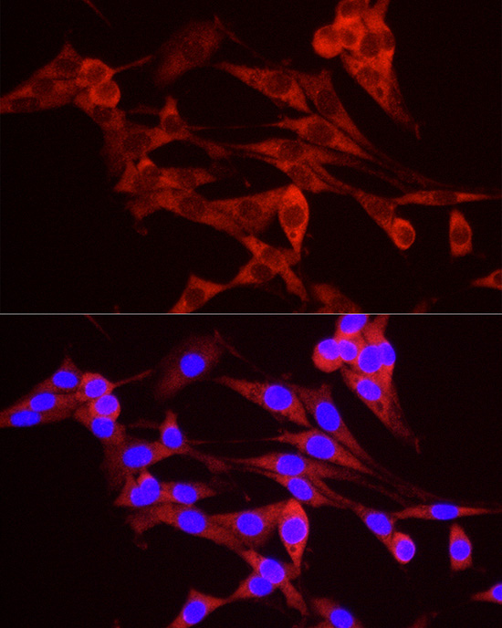 TREX1 Rabbit Polyclonal Antibody - Image 3