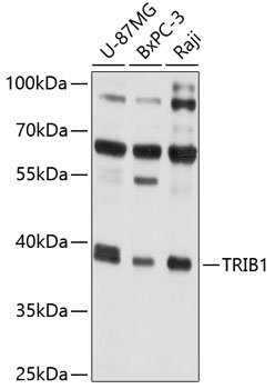 TRIB1 Rabbit Polyclonal Antibody