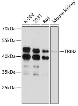TRIB2 Rabbit Polyclonal Antibody