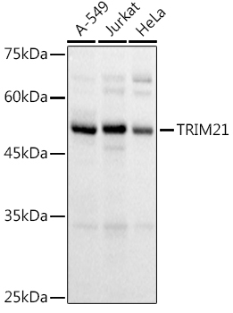 TRIM21/SS-A Rabbit Polyclonal Antibody