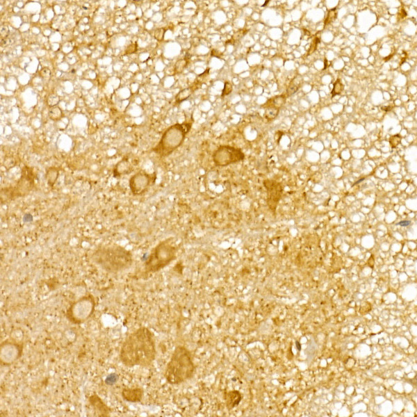 TRIM21/SS-A Rabbit Polyclonal Antibody - Image 2