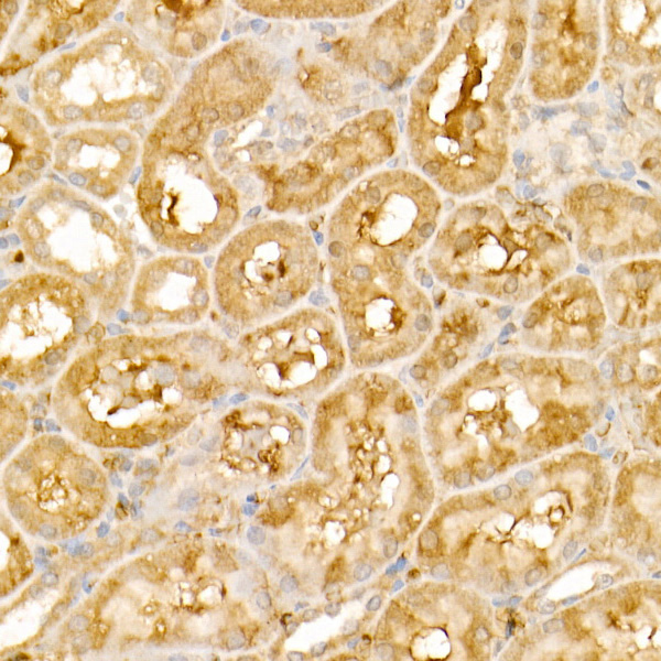 TRIM21/SS-A Rabbit Polyclonal Antibody - Image 3