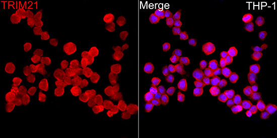 TRIM21/SS-A Rabbit Polyclonal Antibody - Image 4