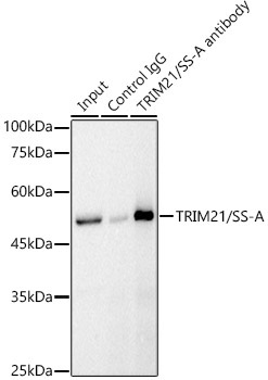 TRIM21/SS-A Rabbit Polyclonal Antibody - Image 5