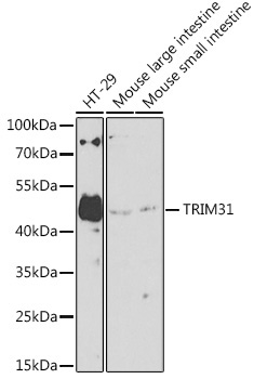 TRIM31 Rabbit Polyclonal Antibody