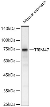 TRIM47 Rabbit Polyclonal Antibody