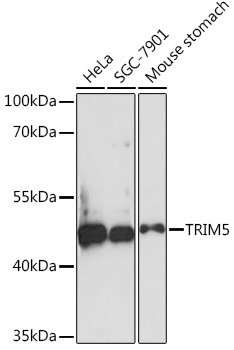 TRIM5 Rabbit Polyclonal Antibody