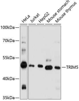 TRIM5 Rabbit Polyclonal Antibody
