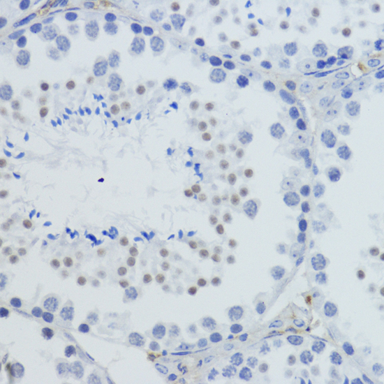 TriMethyl-Histone H4-K20 Rabbit Polyclonal Antibody - Image 4