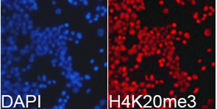 TriMethyl-Histone H4-K20 Rabbit Polyclonal Antibody - Image 5