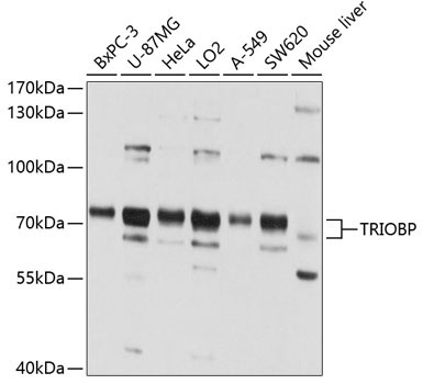 TRIOBP Rabbit Polyclonal Antibody